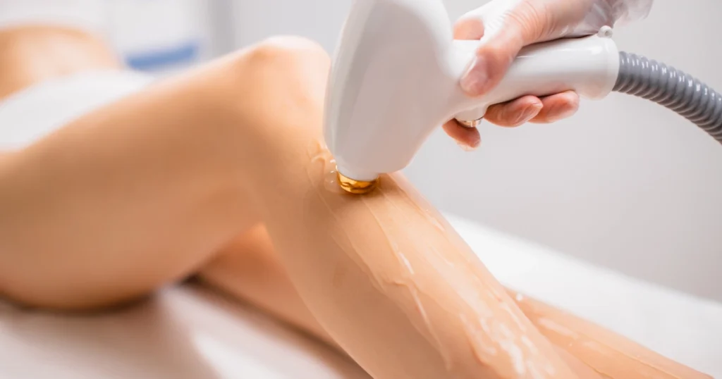 Laser Hair Removal for Sensitive Skin at Gemini Glow Medspa