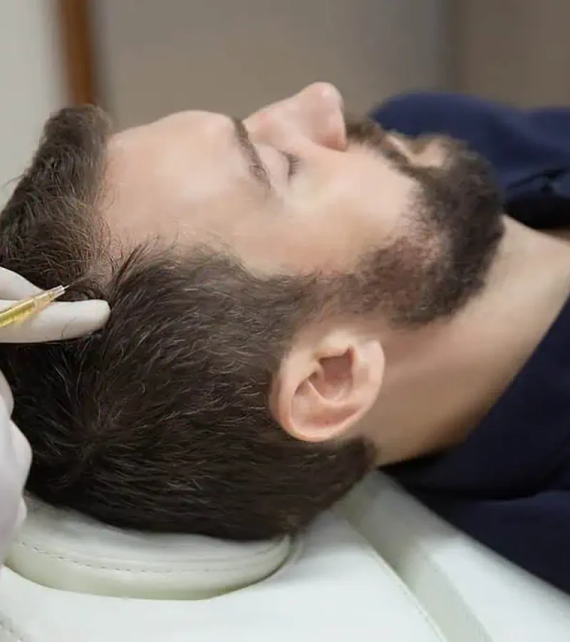 Man getting hair restoration treatment at Gemini Glow Medspa in Taylorsville, UT.
